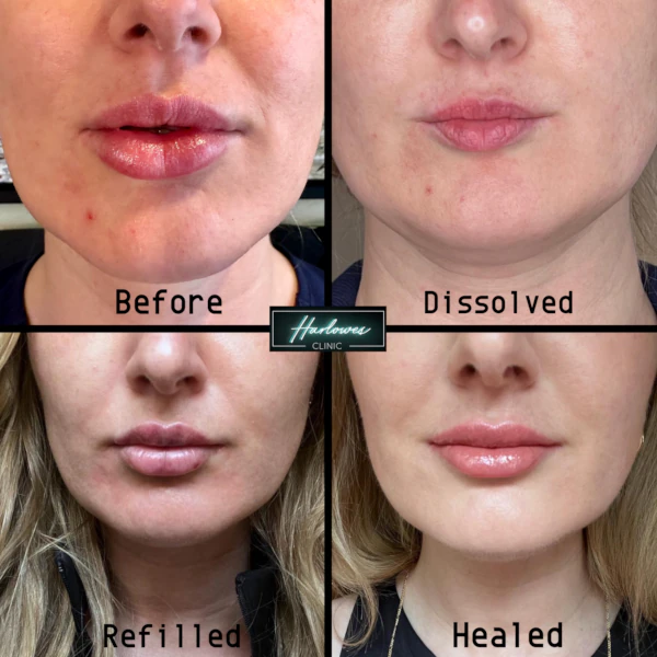 Clarius Ultrasound examples