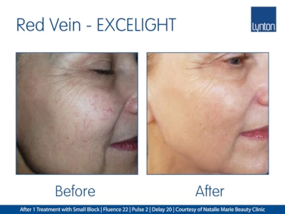 Red Vein