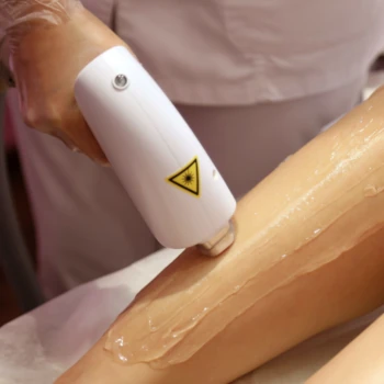 Laser Hair Removeal Treatment