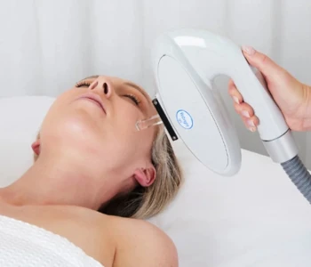 lynton intense pulsed light therapy in action