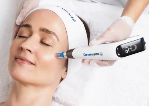 Microneedling Treatments