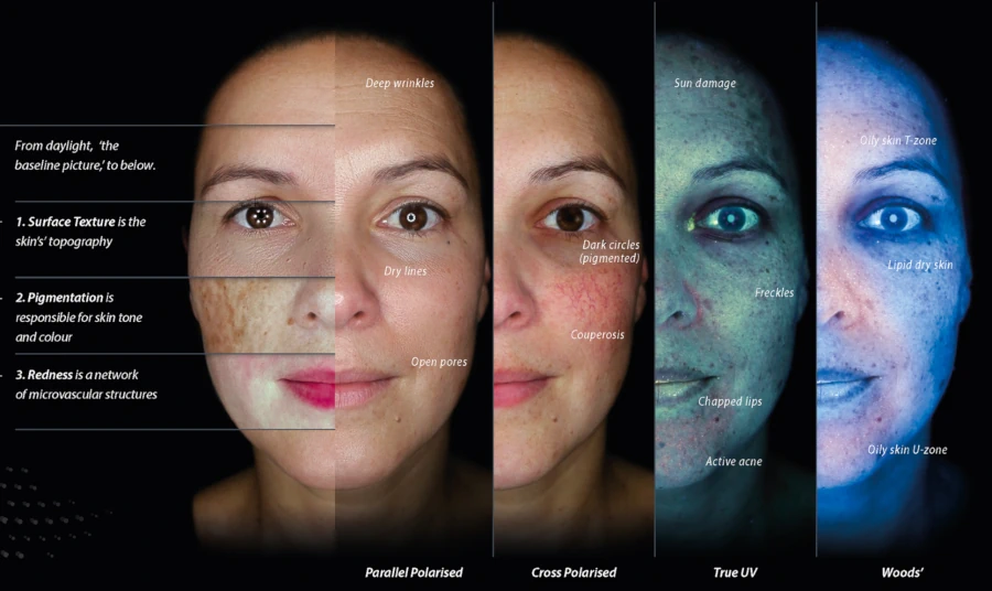 observ skin analysis consultation