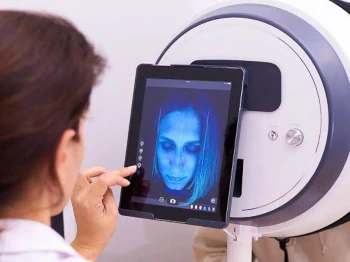 Observ skin analysis