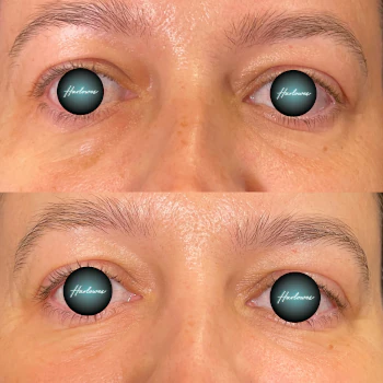 Polynucleotide treatments